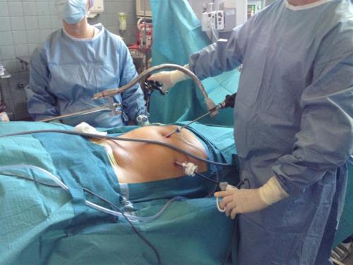 FAP - Quick-Grip Scope Holding
