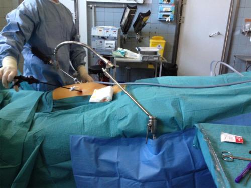 FAP - Quick-Grip Scope Holding (2)