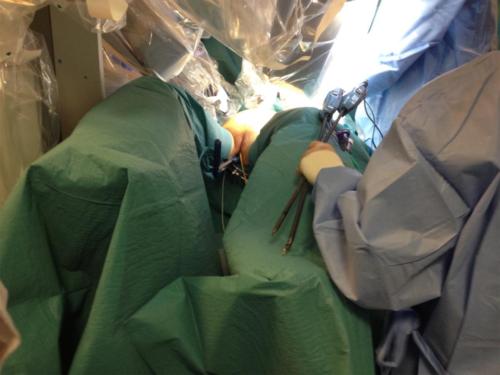 FAP Uterine Manipulator