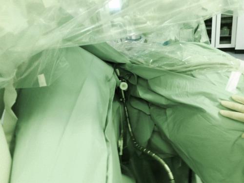 FAP Uterine Manipulator (2)