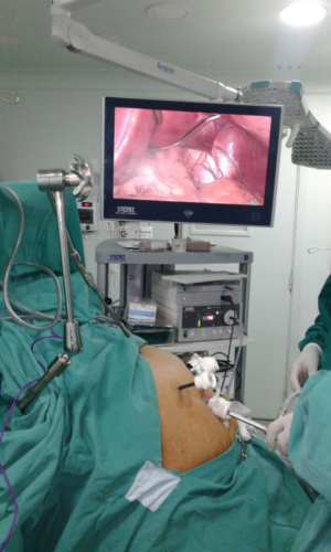 Liver retract monitor