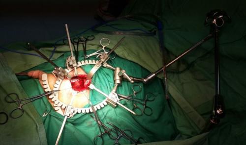 MiniBookler in Urology (1)